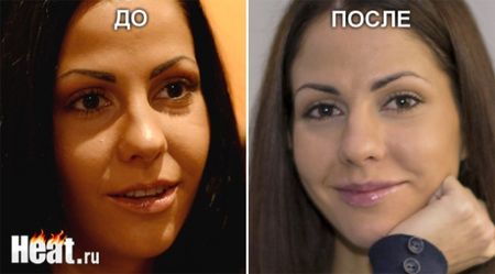 Порнозвезда Елена Беркова сделала неудачную пластику 