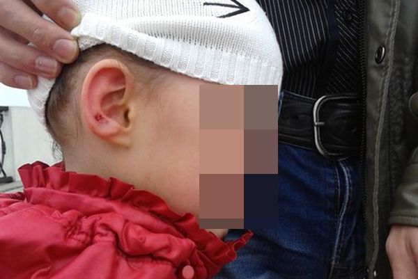 Пуля из пневматического тира попала в ухо ребенку на набережной ижевского пруда 