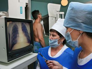 Воткинск бьет рекорды по количеству больных туберкулезом