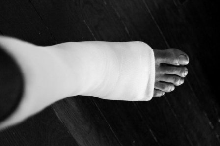 Житель Завьяловского района сломал собутыльнику правую ногу