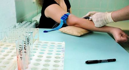 В Воткинске увеличилось число ВИЧ-инфицированных