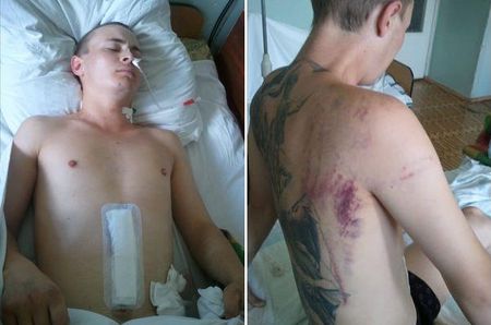 Следствие: ижевчанина Григория Щербакова избивал не полицейский 