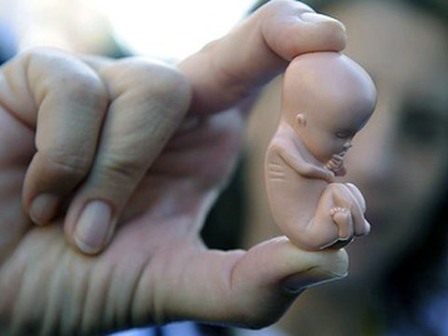 Госдума рассмотрит законопроекта о запрете абортов в частных клиниках