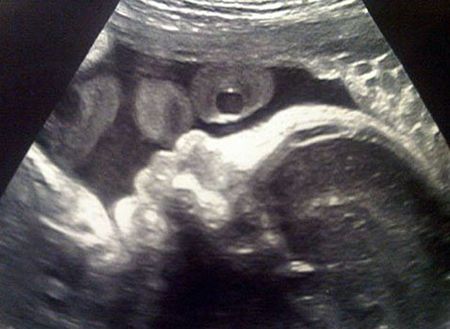 Фото: Шакира показала фото своего будущего ребенка