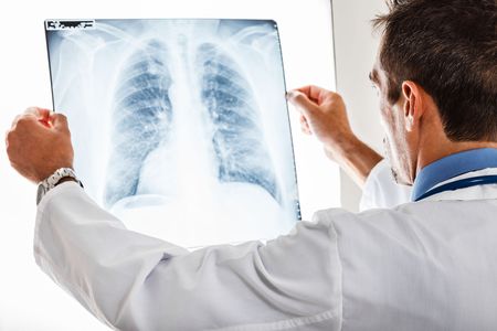 Почти 600 новых случаев туберкулеза зарегистрировали в Удмуртии с начала года
