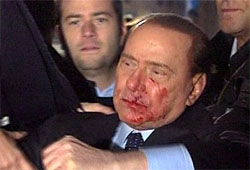 В Сильвио Берлускони псих бросил тяжелый предмет, разбив ему губу и сломав нос