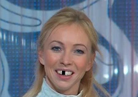Татьяна Тотьмянина выбила зуб на тренировке