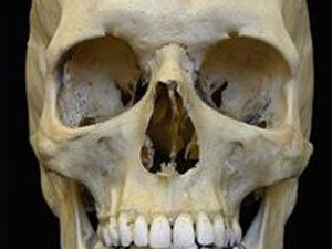 В лесу Удмуртии обнаружен человеческий череп